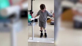 Young boy walks for the first time after leg amputation - Fox News